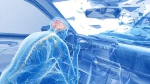 illustration in 3d of man hitting head on steering wheel of car one of the common causes of brain injuries
