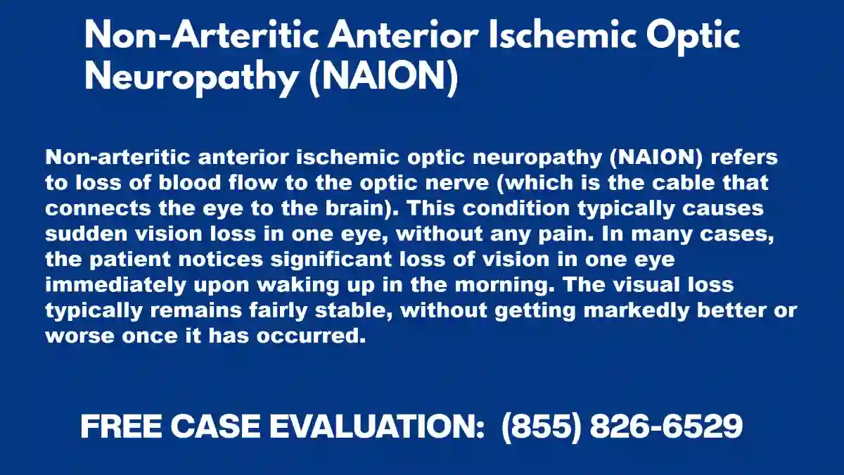 Non-Arteritic Anterior Ischemic Optic Neuropathy (NAION) used in Mounjaro Eye Problems