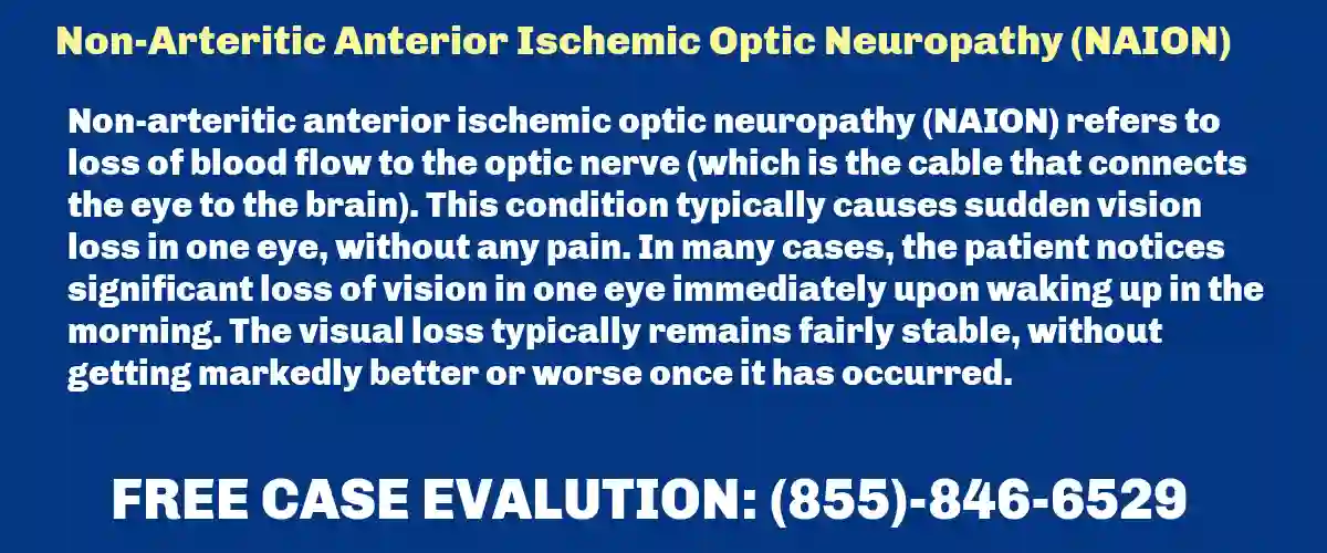 Mounjaro Eye Side Effects Lawsuit, Nonarteritic Anterior Ischemic Optic Neuropathy