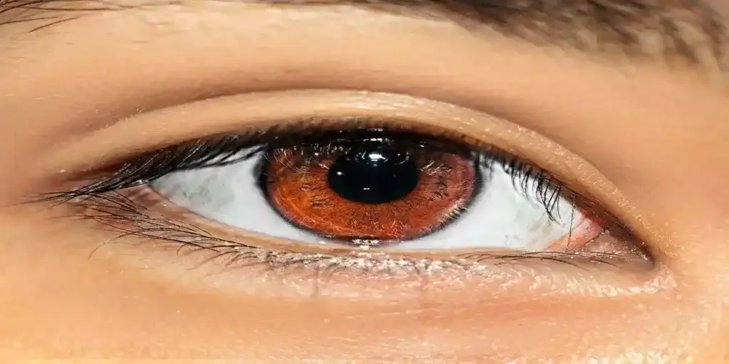 Wegovy Blindness Lawyer