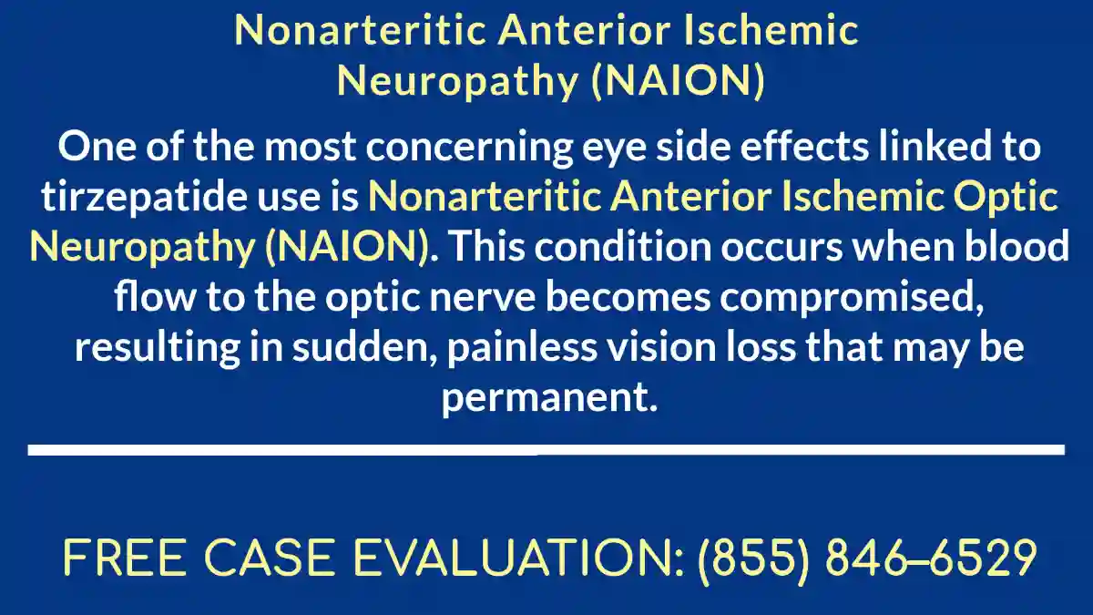 atty chart defining NAION in Zepbound and NAION