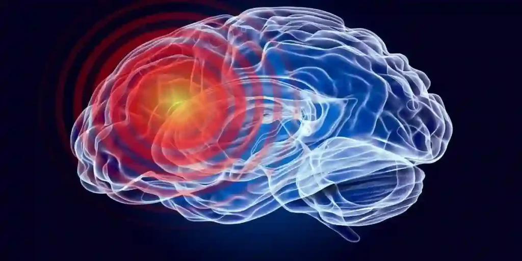 Anatomical depiction of brain damage, showcasing a focal point of injury, inflammation, or neurological disorder in the cerebrum