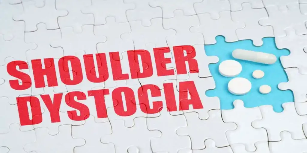 Medical concept. On the puzzles there is an inscription - Shoulder Dystocia, on a blue background pills. used in Shoulder Dystocia Malpractice Lawyer in Nashville